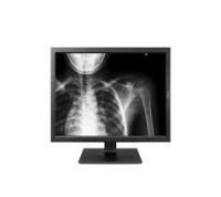 LG monitor medicinski klinični 19HK312C 1,3MP