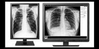 LG monitor diagnostični 21HK512D 3MP